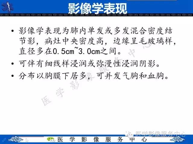 【病例】肺血管肉瘤1例CT影像表现
