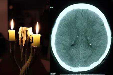 这10个经典神经影像,你能认出几个 这10个经典神经影像,你能认出几个