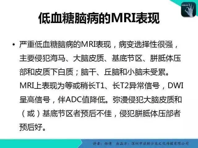 【病例】低血糖脑病一例MR影像表现