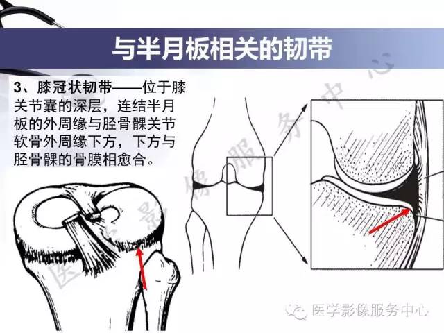 【PPT】半月板病变的MRI诊断