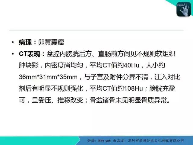 【病例】卵黄囊瘤一例CT影像表现