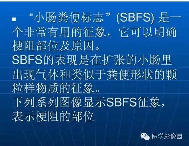 【PPT】急腹症X线、CT诊断与鉴别诊断
