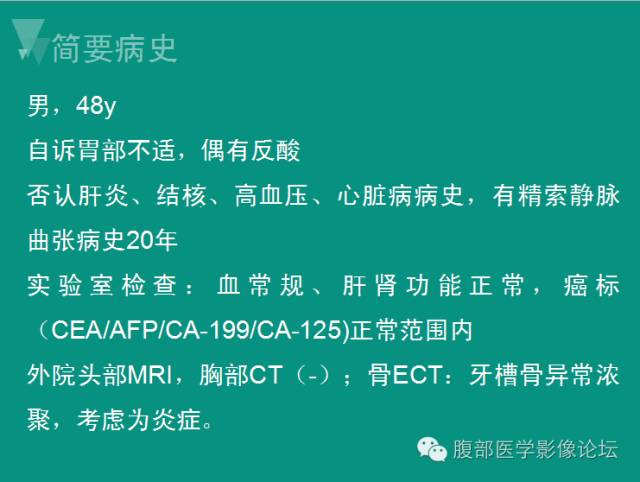 【病例】肝脏神经内分泌肿瘤NET一例CT影像表现