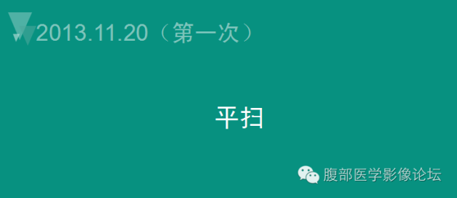 【病例】肝脏神经内分泌肿瘤NET一例CT影像表现 【病例】肝脏神经内分泌肿瘤NET一例CT影像表现