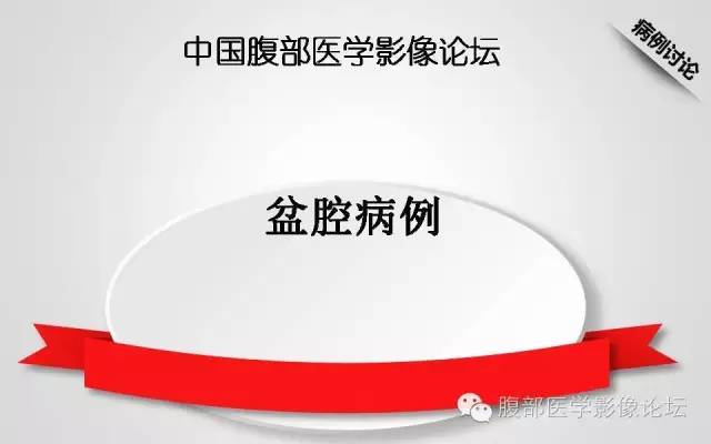 【病例】卵巢甲状腺肿1例CT及MR影像表现