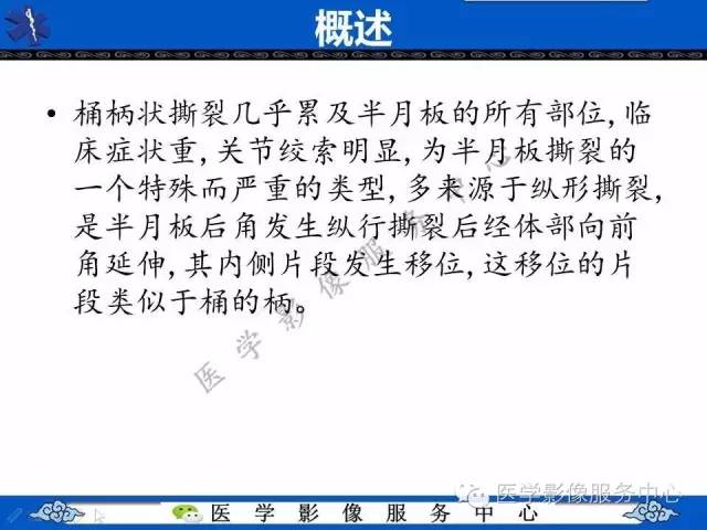 【影像征象】双后交叉韧带征