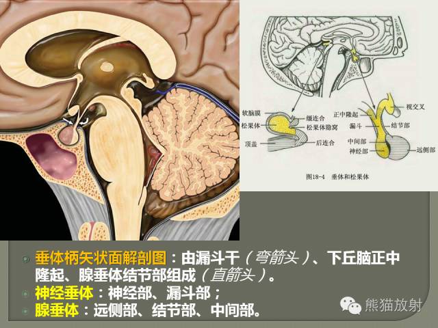 【PPT】垂体柄解剖及病变