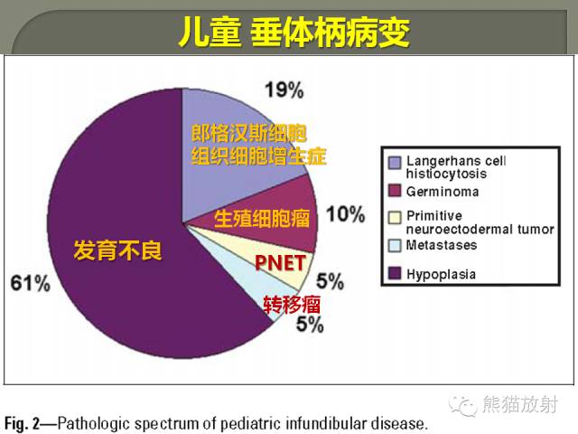 【PPT】垂体柄解剖及病变