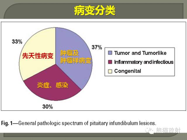 【PPT】垂体柄解剖及病变