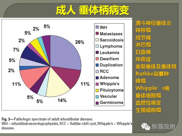 【PPT】垂体柄解剖及病变