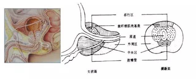 前列腺磁共振常规检查指南 前列腺磁共振常规检查指南