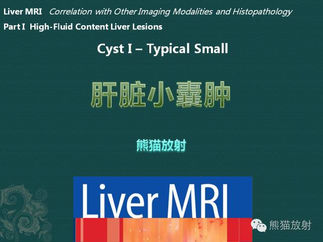【PPT】肝脏小/大囊肿MRI表现