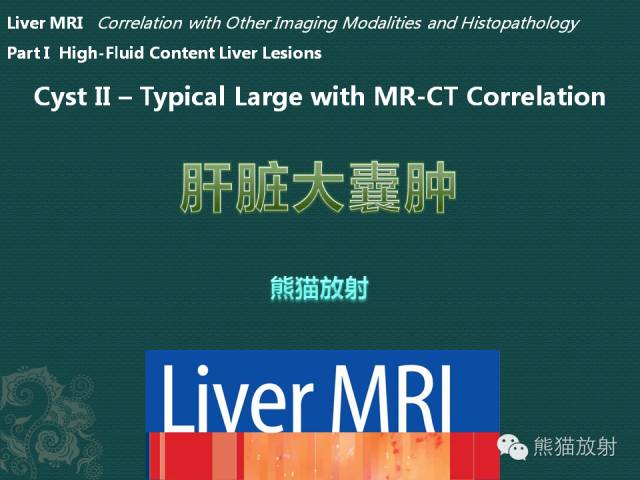【PPT】肝脏小/大囊肿MRI表现