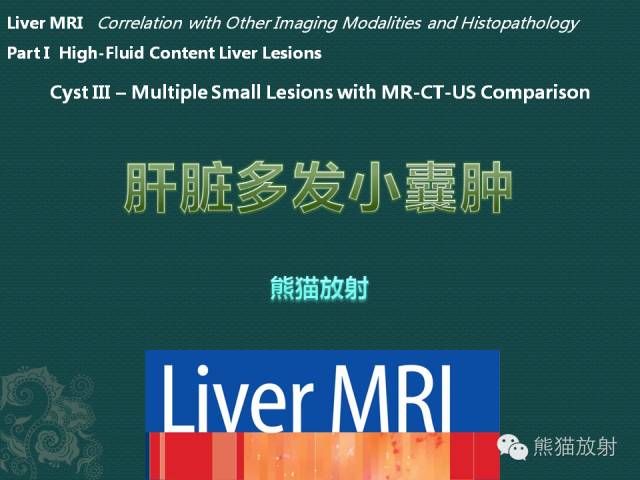 【MRI入门】肝脏多发小囊肿及多囊肝的MRI表现