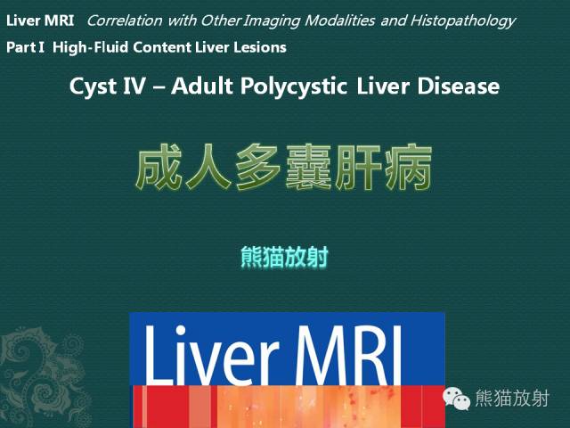 【MRI入门】肝脏多发小囊肿及多囊肝的MRI表现