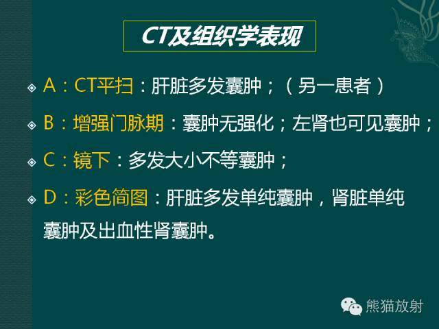 【MRI入门】肝脏多发小囊肿及多囊肝的MRI表现
