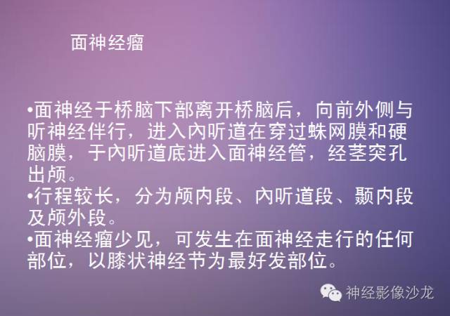 【病例】听神经瘤1例CT及MR影像表现与鉴别