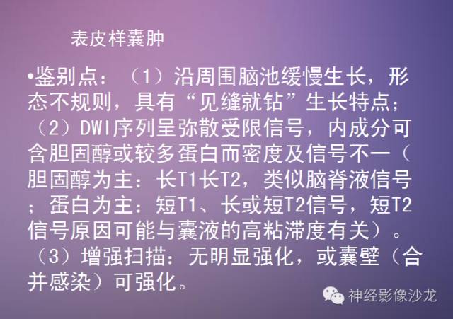 【病例】听神经瘤1例CT及MR影像表现与鉴别