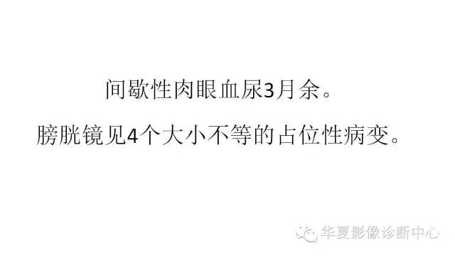 【病例】腺性膀胱炎1例CT影像表现