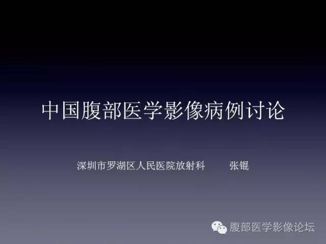 【病例】左侧肾上腺恶性纤维组织细胞瘤1例CT病例讨论