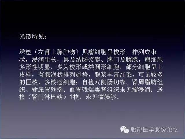 【病例】左侧肾上腺恶性纤维组织细胞瘤1例CT病例讨论