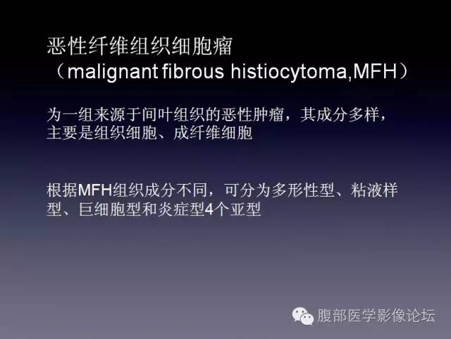 【病例】左侧肾上腺恶性纤维组织细胞瘤1例CT病例讨论