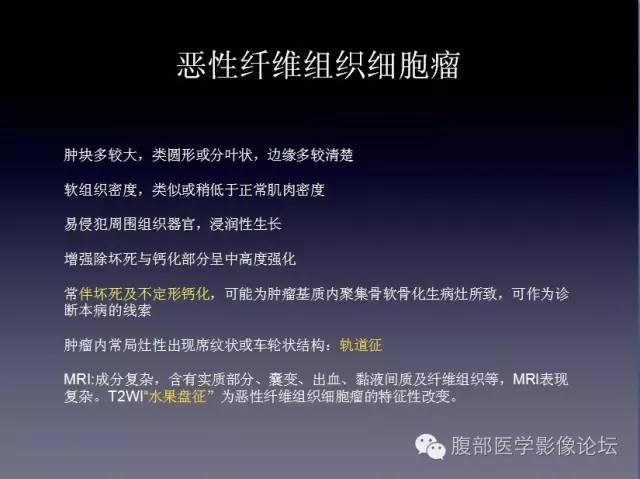 【病例】左侧肾上腺恶性纤维组织细胞瘤1例CT病例讨论