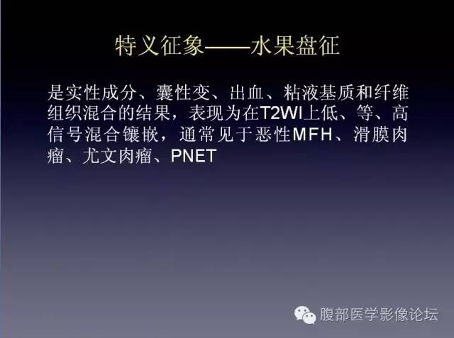 【病例】左侧肾上腺恶性纤维组织细胞瘤1例CT病例讨论