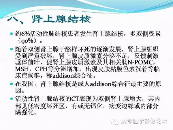 【PPT】腹部结核