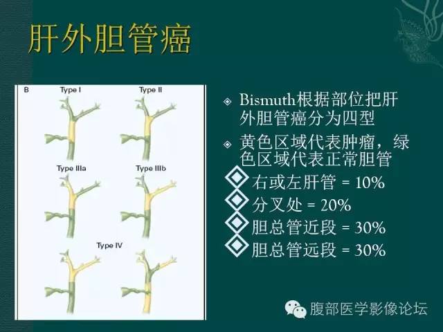 【PPT】胆管癌的CT诊断