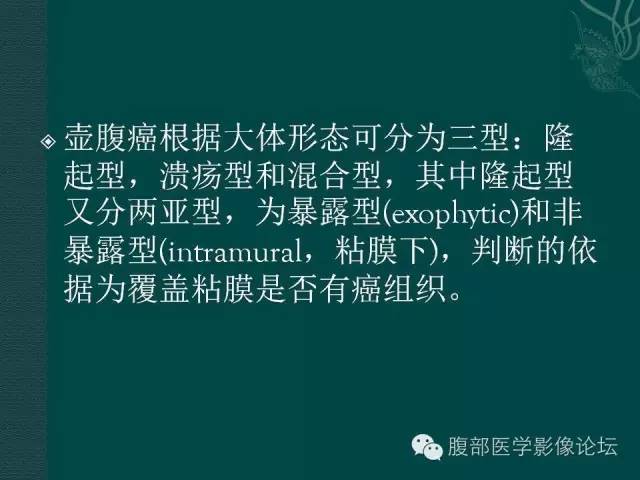【PPT】胆管癌的CT诊断