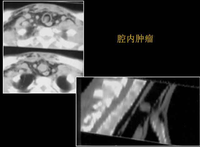 这些也是肺部常见病的基本征象,你都知道么? 这些也是肺部常见病的基本征象,你都知道么?