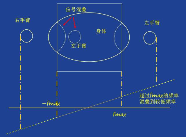 MRI常见伪影| 用角度看伪影 MRI常见伪影| 用角度看伪影