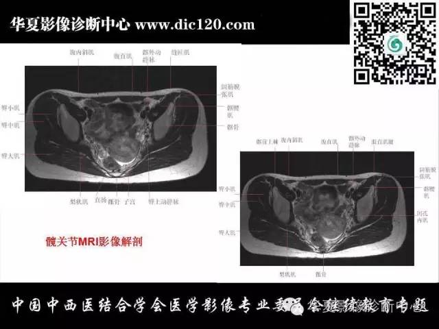 【PPT】髋关节常见疾病影像学诊断