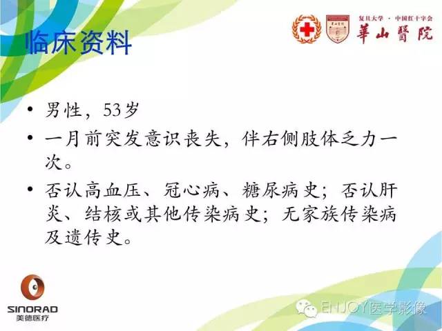 【病例】原发性中枢神经系统血管炎1例MR影像表现