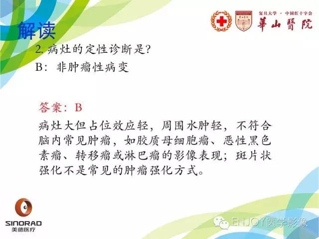 【病例】原发性中枢神经系统血管炎1例MR影像表现