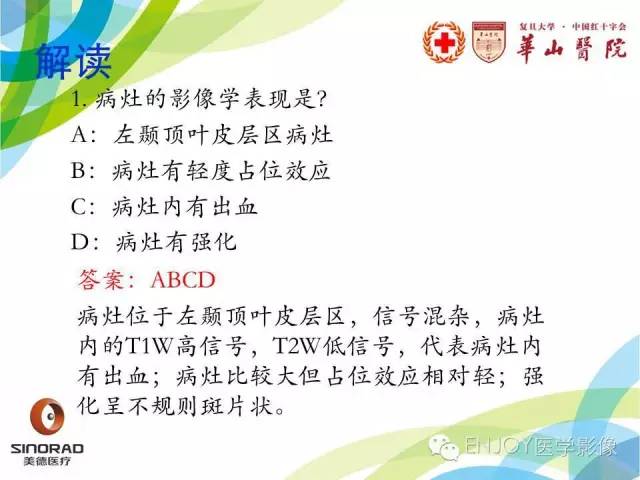 【病例】原发性中枢神经系统血管炎1例MR影像表现