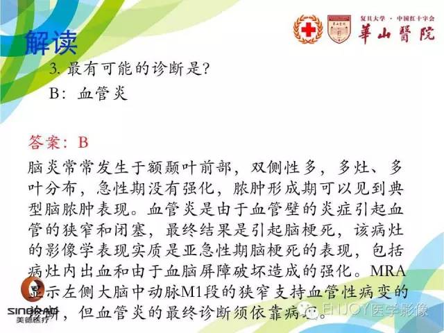【病例】原发性中枢神经系统血管炎1例MR影像表现