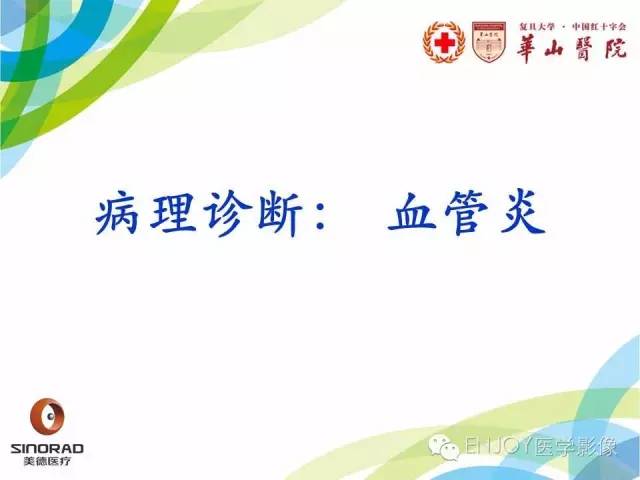 【病例】原发性中枢神经系统血管炎1例MR影像表现