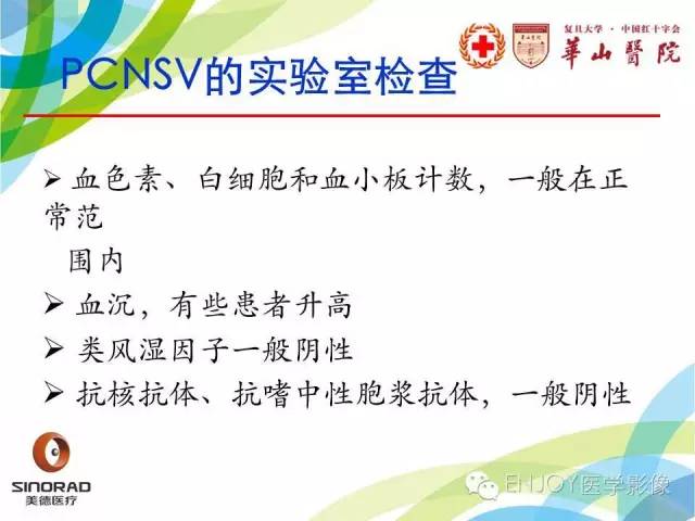 【病例】原发性中枢神经系统血管炎1例MR影像表现