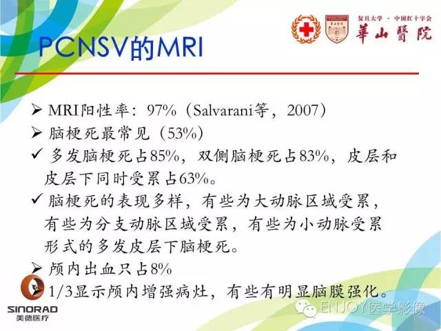 【病例】原发性中枢神经系统血管炎1例MR影像表现