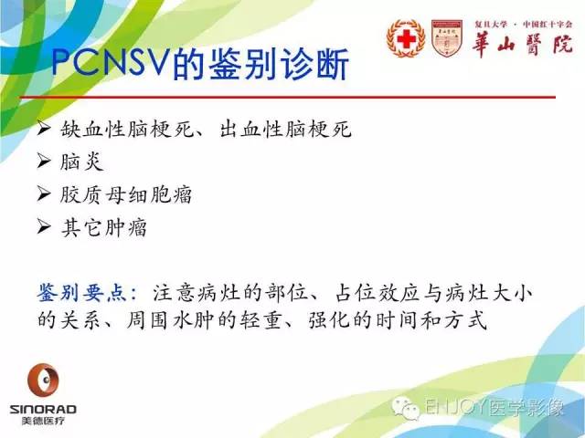 【病例】原发性中枢神经系统血管炎1例MR影像表现
