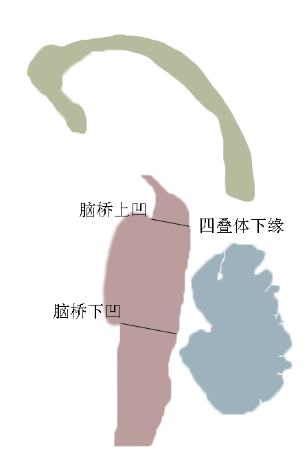 进行性核上性麻痹MRI特点——只知道蜂鸟征? 进行性核上性麻痹MRI特点——只知道蜂鸟征?