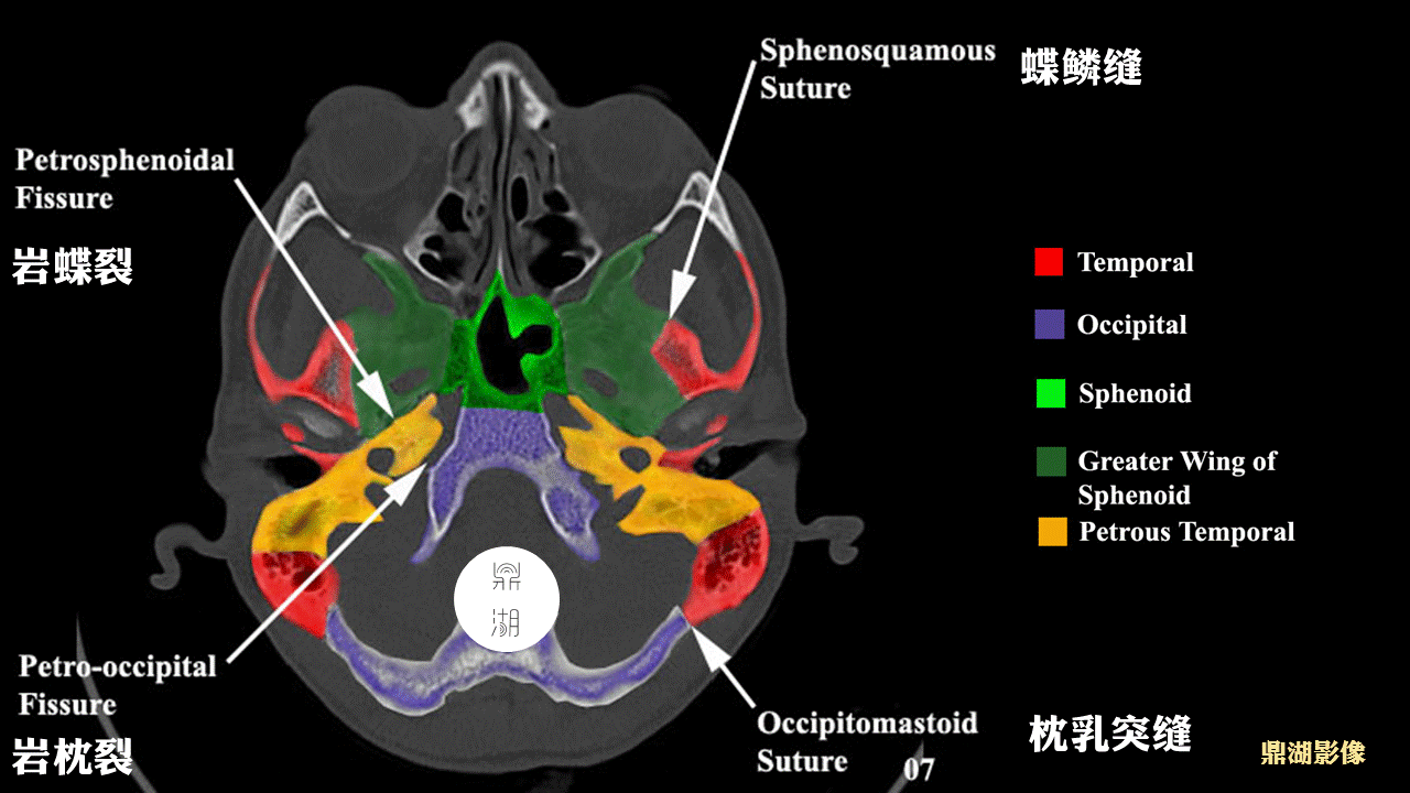 超精致颅底断层解剖