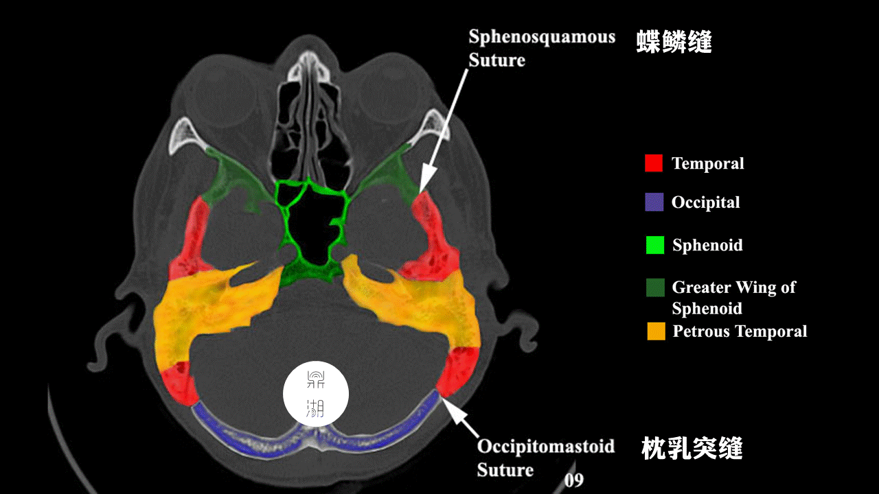 超精致颅底断层解剖