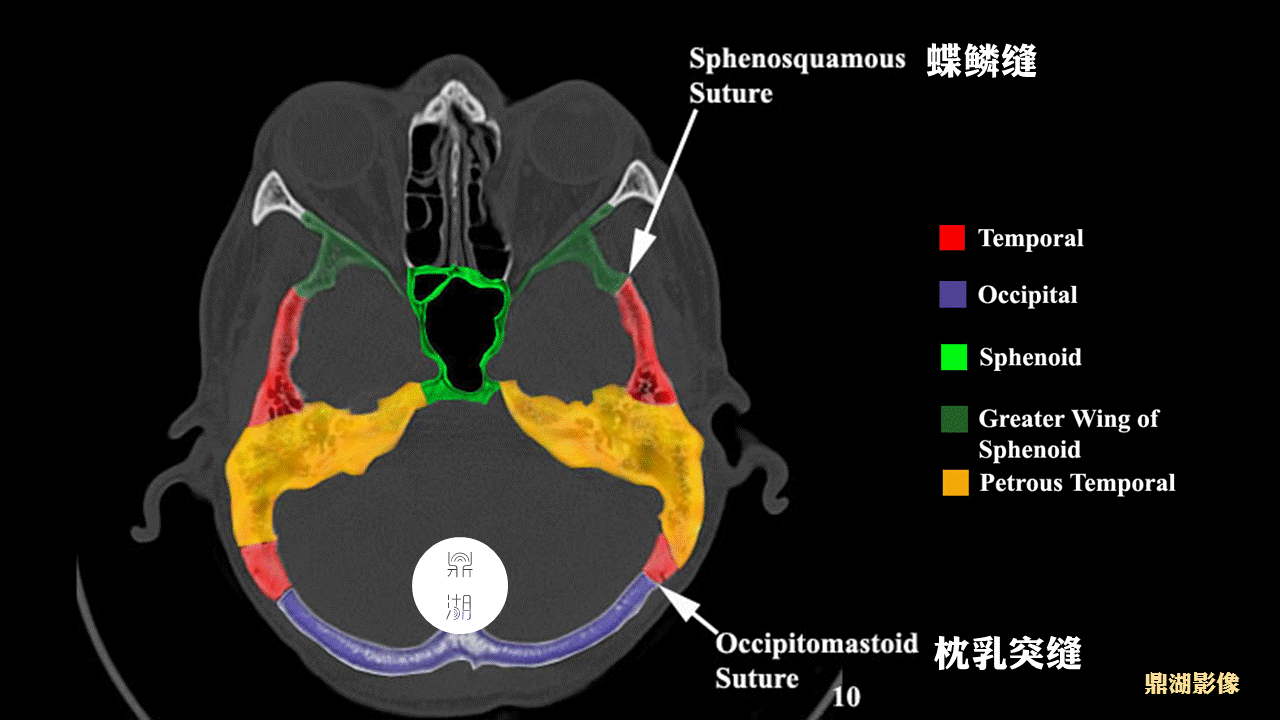 超精致颅底断层解剖