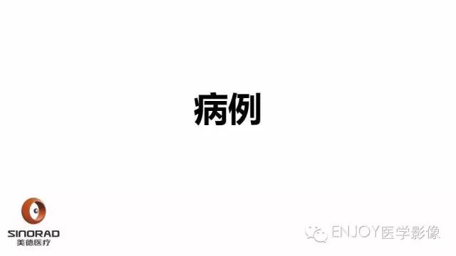 【病例】卵巢交界性浆液性表面乳头状瘤1例MR病例读片