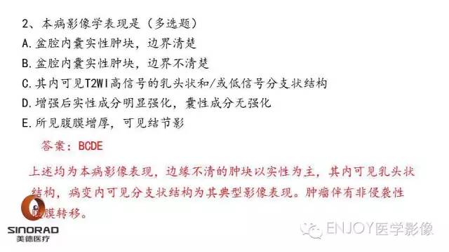 【病例】卵巢交界性浆液性表面乳头状瘤1例MR病例读片