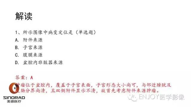 【病例】卵巢交界性浆液性表面乳头状瘤1例MR病例读片