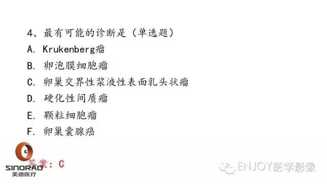 【病例】卵巢交界性浆液性表面乳头状瘤1例MR病例读片